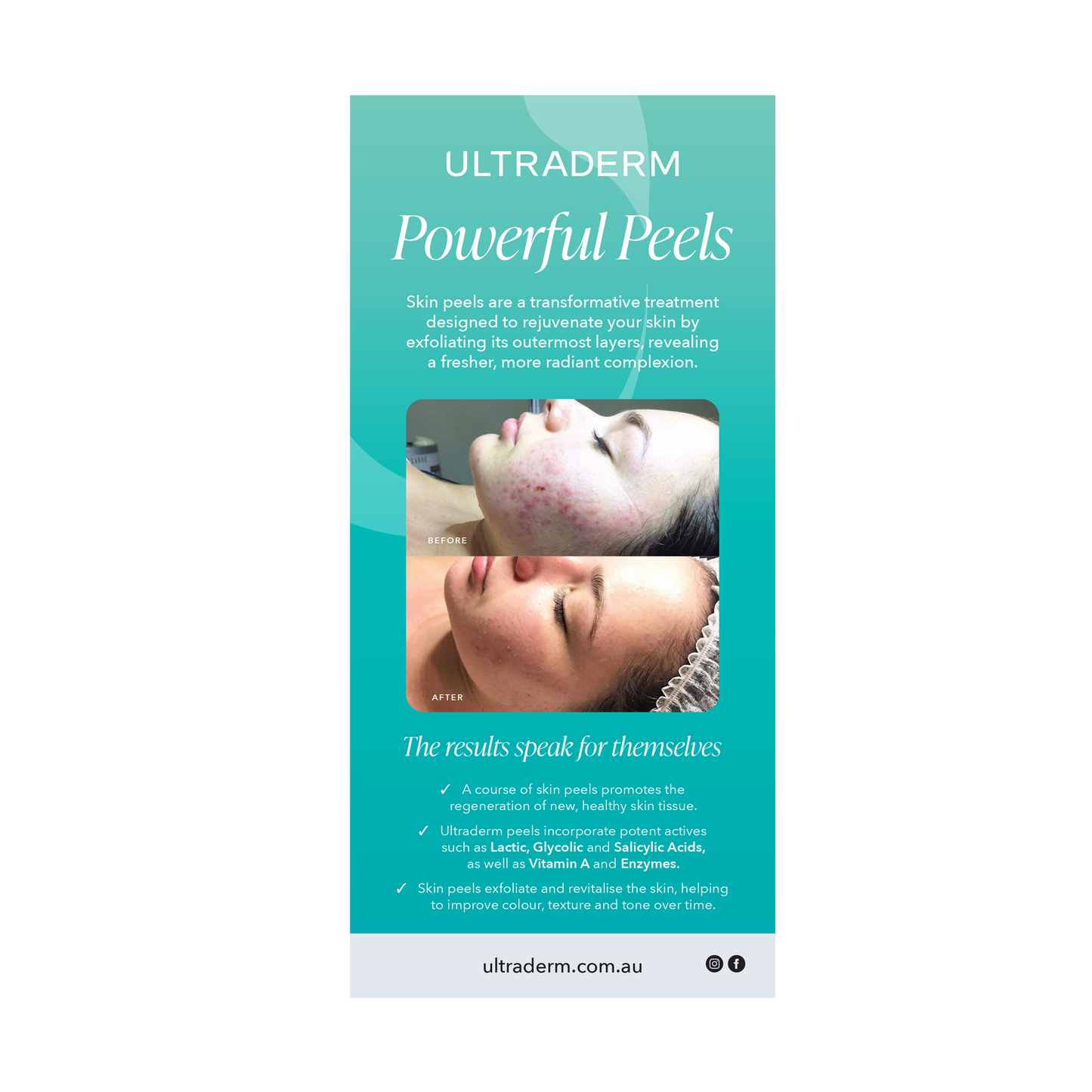 Retail DL Product Flyers