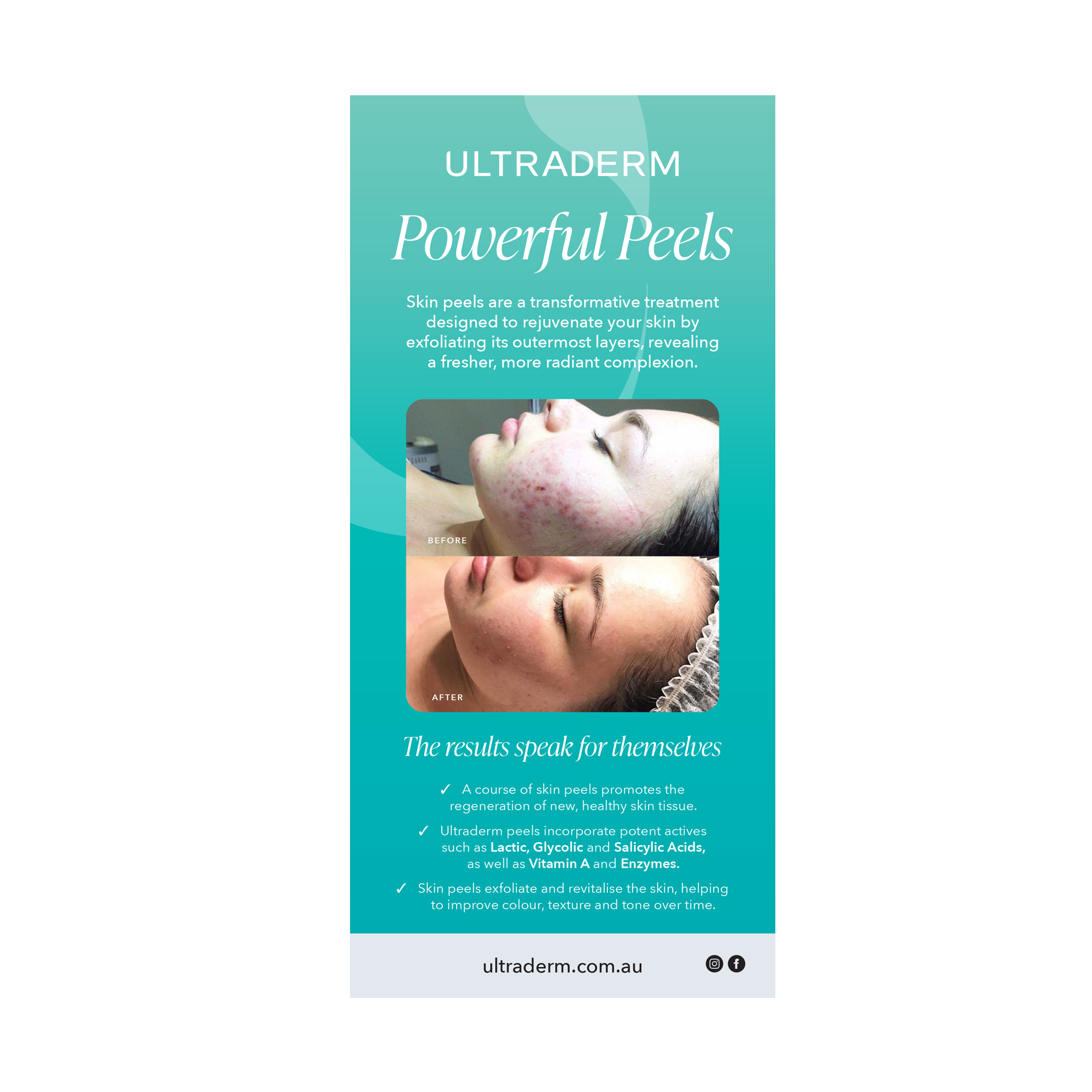 Facial Treatment Flyers (DL Size)