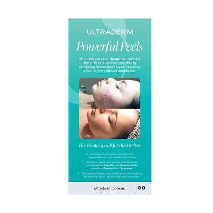 Facial Treatment Flyers (DL Size)
